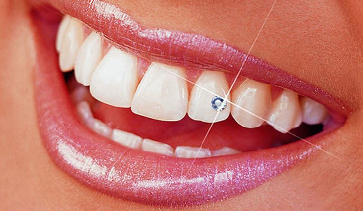 Blog 12 Brillantino al dente