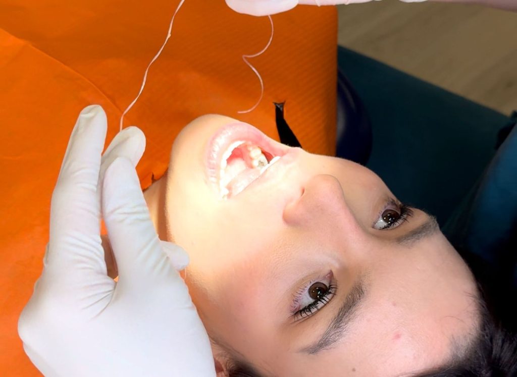 Pulizia dei denti a Firenze