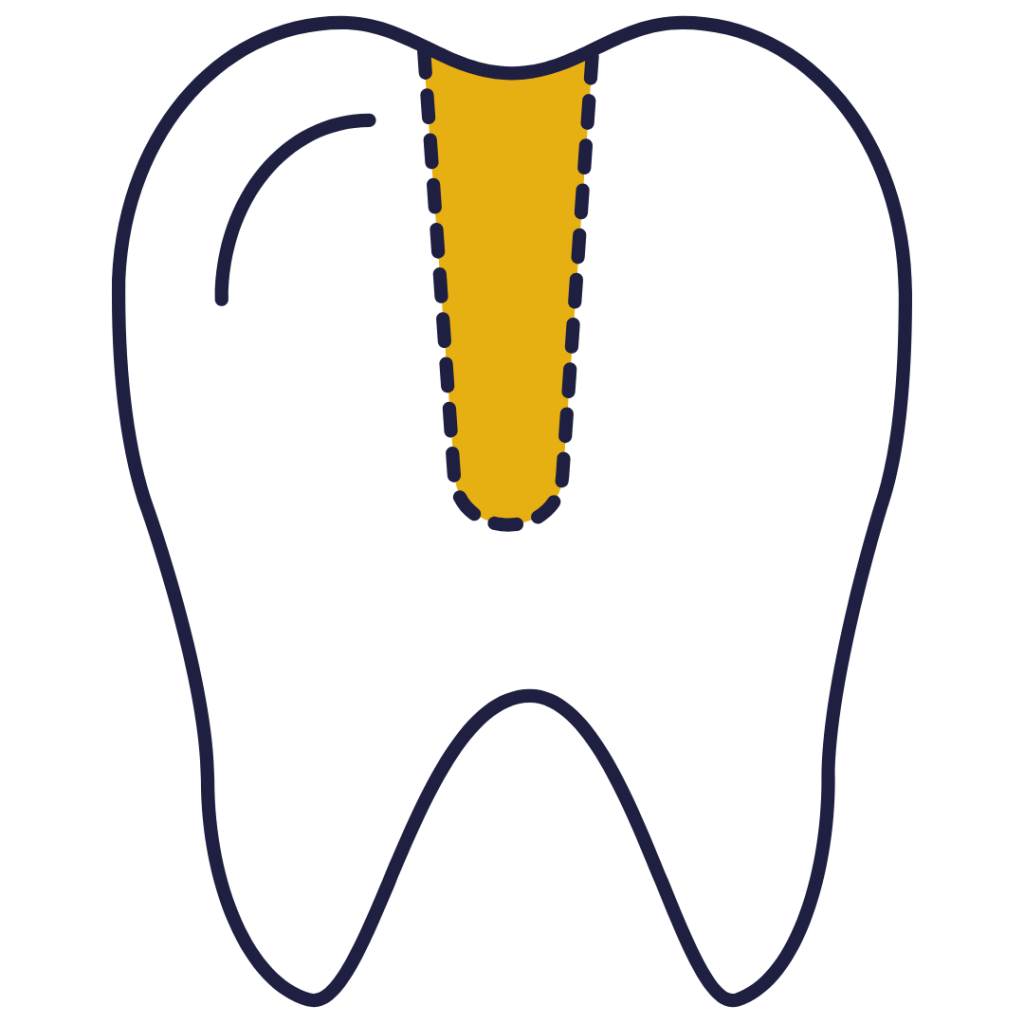 Endodonzia
