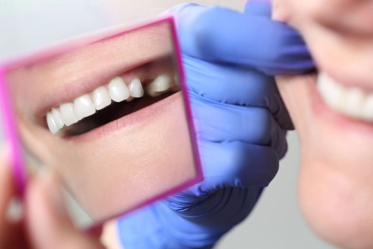 Blog 3 Come si fa un impianto dentale a Firenze