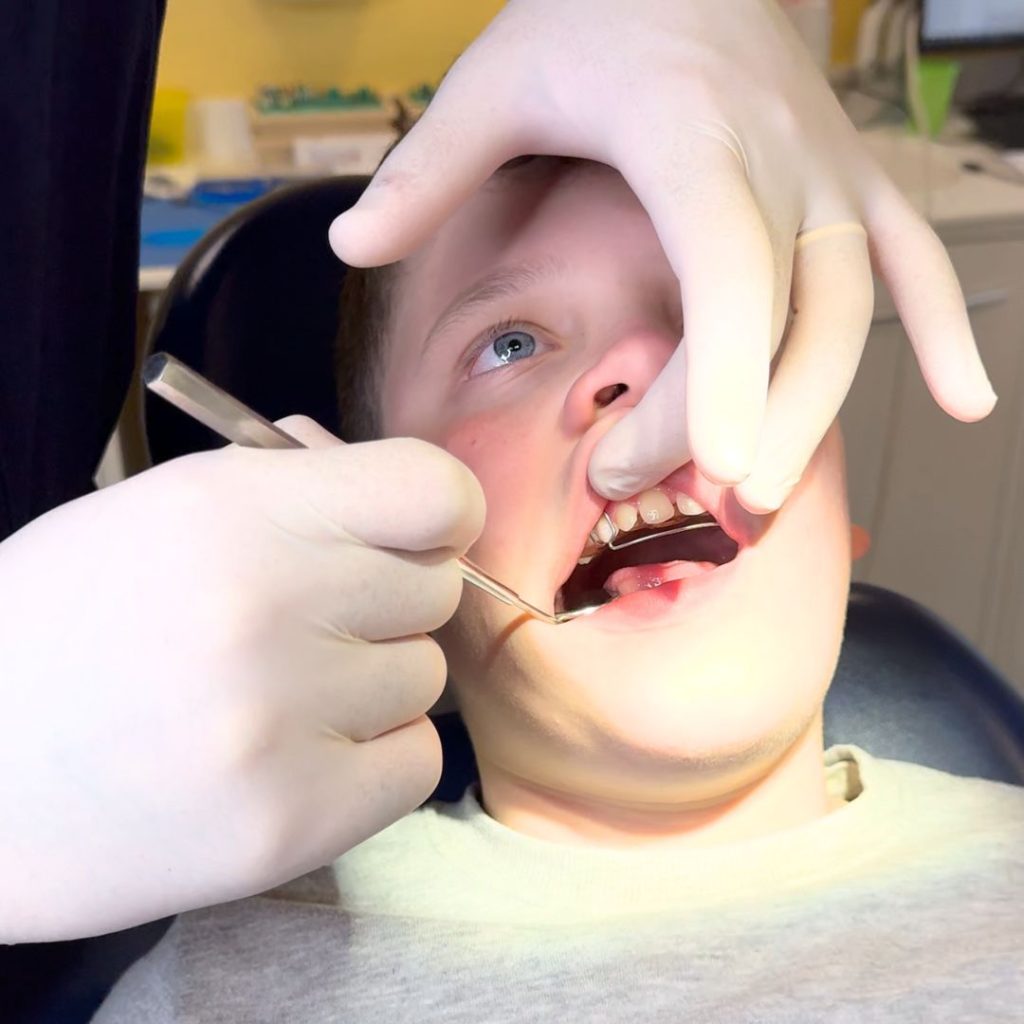 Pedodonzia 1 dentista per bambini a Firenze e Prato