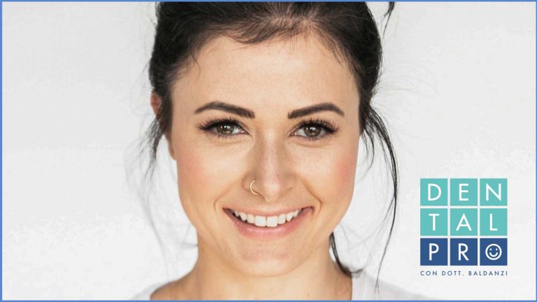 Blog 9 allineare i denti