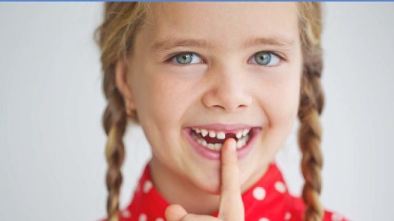 Blog 13 Dente da latte