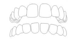 37115546-0-3