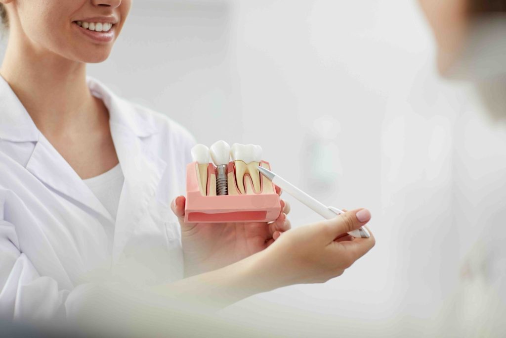 Implantologia dentale pro e contro a Prato