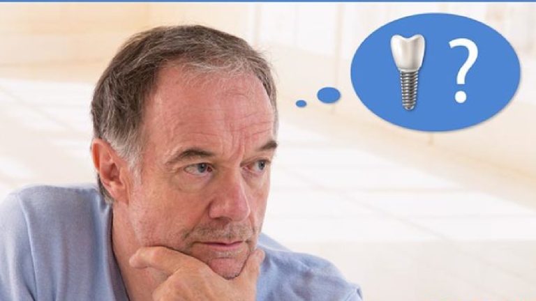Blog 9 QUANTO COSTA UN IMPIANTO DENTALE